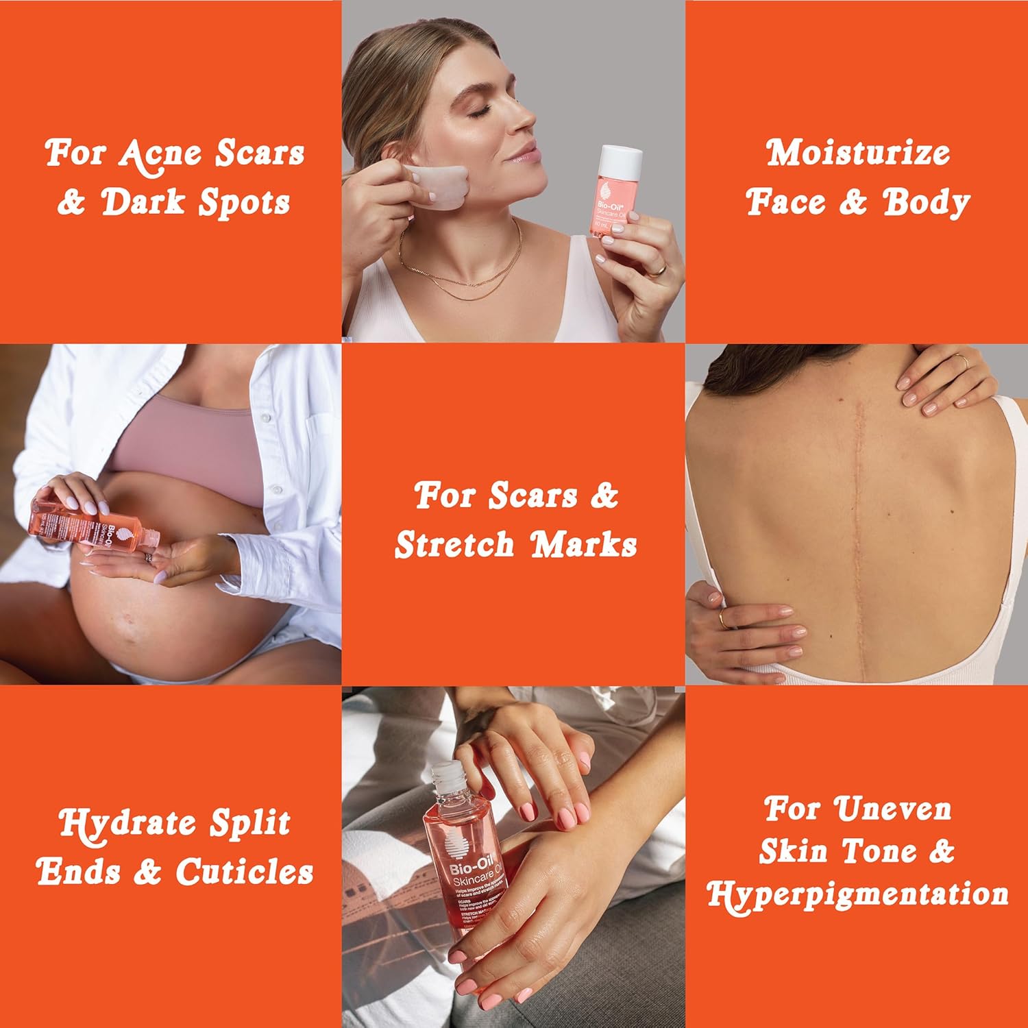 Bio-Oil Skincare Oil, 6.7 Ounce, Body Oil for Scars and Stretchmarks, Hydrates Skin, Non-Greasy